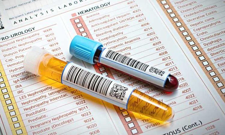 urine blood tests.jpg