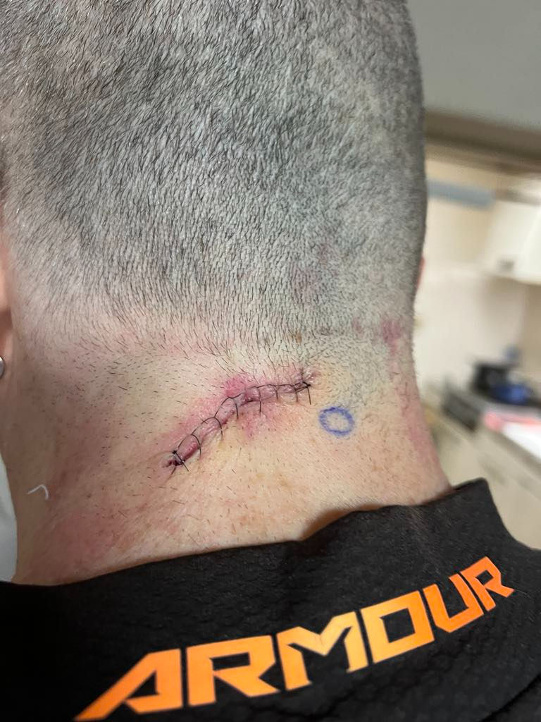 That pretty much says it all. Ouch, and not much to look at. Better than the alternative, of course.