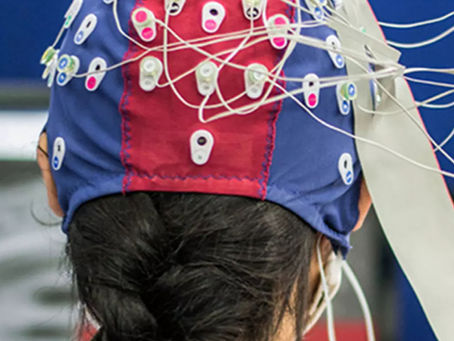 Électroencéphalographie (EEG) : une fenêtre en temps réel sur le cerveau