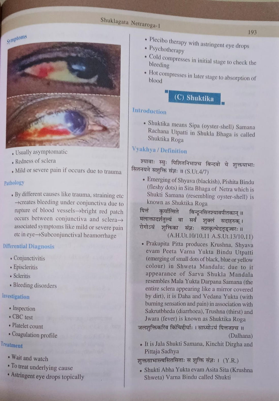 Thumbnail: Shalakya Tantra Netra Chikitsa Vignyan- Ophthalmology- Part-1 (E) byDr.Joshi