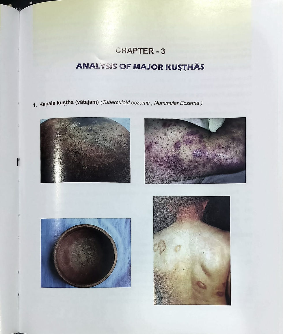 Thumbnail: Ayurvedic Dermatology And Venereology-By  Dr. L. Mahadevan