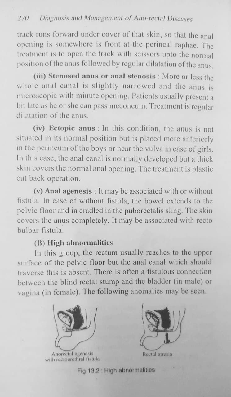 Thumbnail: Diagnosis and Management of Ano-Rectal Diseases (E) by Dr. Praveen Kumar