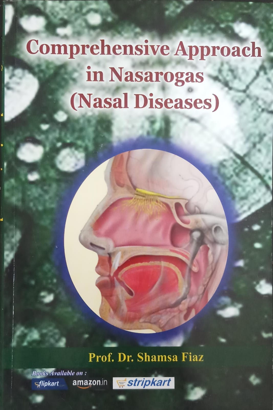 Comprehensive Approach In Nasarogas/ Nasal Diseases(E) By Prof.Dr. Shamsa Fiaz
