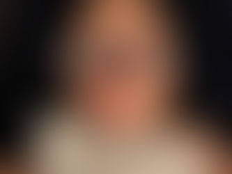 AJ's Coloboma: Partial or Blind