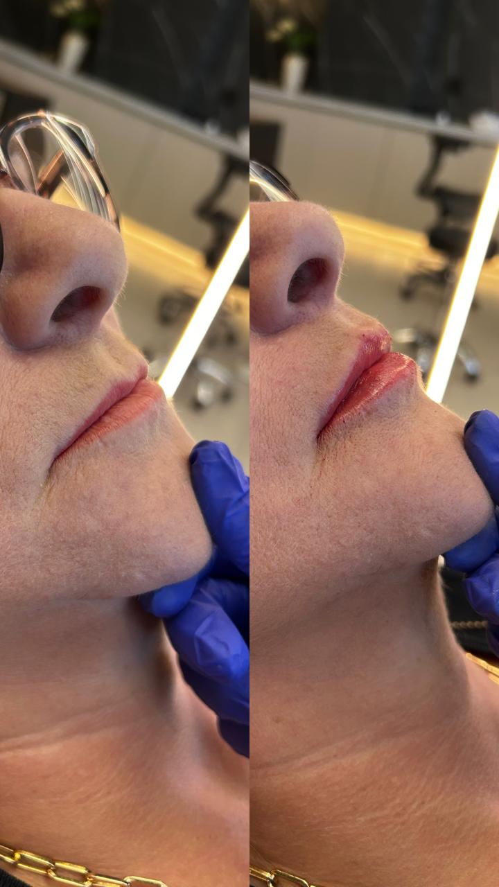 Tratamento estético