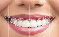 smile designing.png