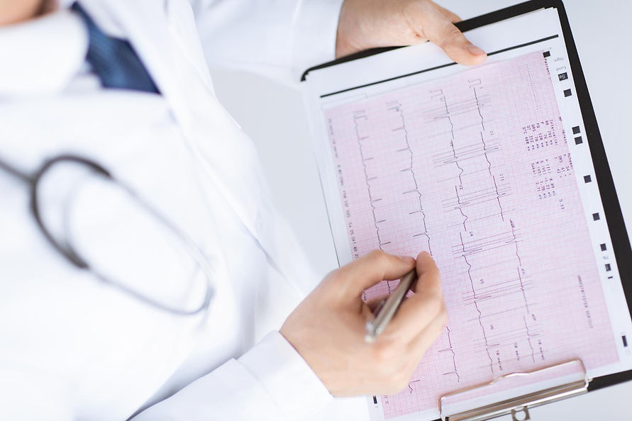 electrocardiogram.jpeg
