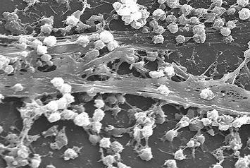 Staphylococcus_aureus_biofilm_01-596x400.jpeg