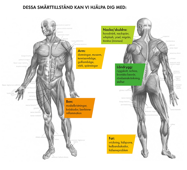 Naprapat_smärtkarta.png