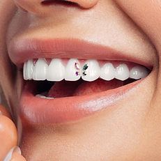 tooth gem.jpg