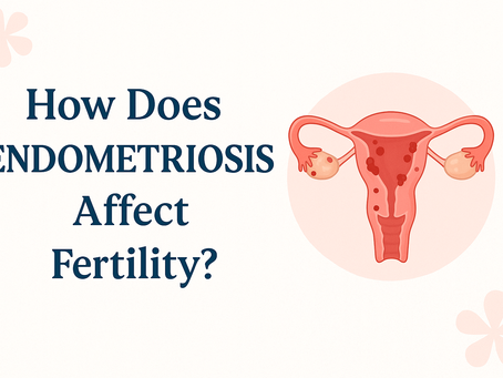 How Does Endometriosis Affect Fertility?