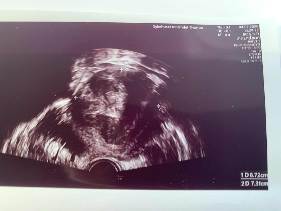 Muskelknute del 3. Besøket på Elverum Gynekologisk, hva skal vi gjøre med knuten?