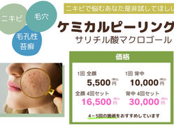 ニキビでお悩みの方へ
