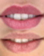 ree