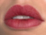 6. Lippen am 3. Tag Die Trockenheit nimmt weiter zu. An einigen Stellen beginnen sich feine Risse zu bilden, die später zu Krüstchen werden – ein ganz normaler Teil der Heilungsphase.