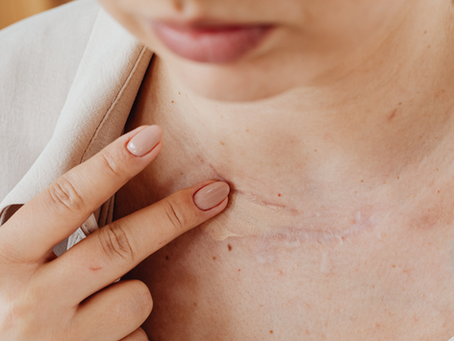 Enhance Confidence with Paramedical Tattooing