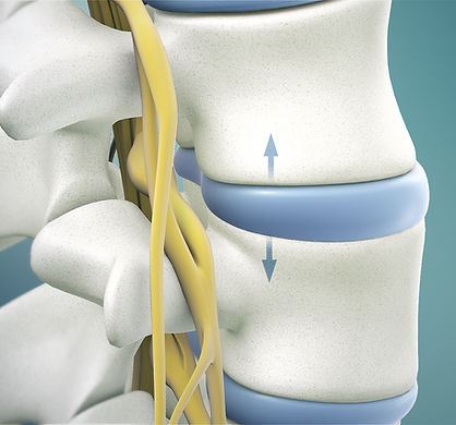 Spinal_Decompression.jpg