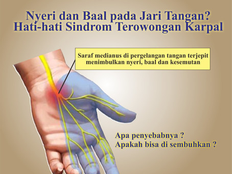 Nyeri dan Baal pada Jari Tangan? Oleh : dr Yovita Stevina Sutantio Sp.N