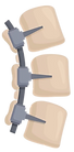 Instrumental para Implante de Columna