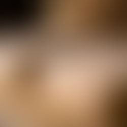 Project: Custom Kitting Design