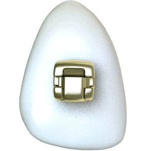 A spinning tooth with gold braces