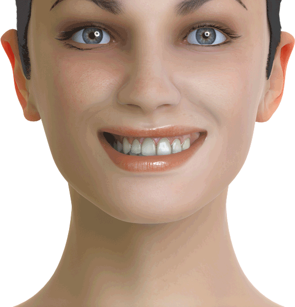 Simulation showing the impact of dental midline on smile aesthetics