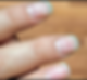 Close-up of fingers showing nails with white horizontal lines. Skin is light-toned.