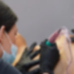 Practitioner performing inkless scar treatment on the chest area using a microneedling technique to support skin regeneration.