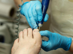 Toenail Damage: Common Causes, Care and When to Seek Help