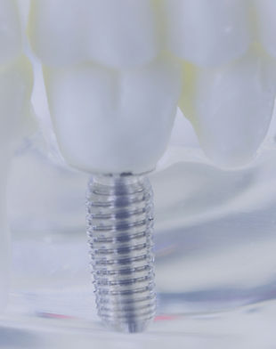 TO soon (2)_edited.jpg