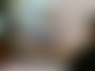 50肩 2回目施術後 外転動作の可動域が広がりました