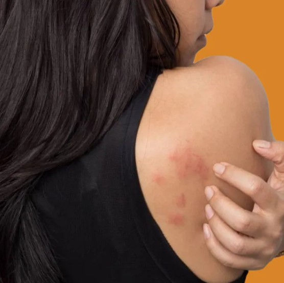 Skin Problems Best Treatment in Patna, Bihar