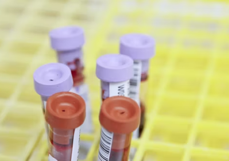Know Your Blood Parameters: Potassium