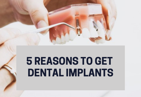 5 Reasons To Get Dental Implants