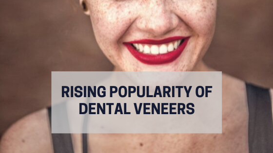 veneers-perfect-teeth-hollywood-smile-dentist-dental-popular-instagram-model