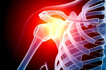 iStock-Shoulder.jpeg