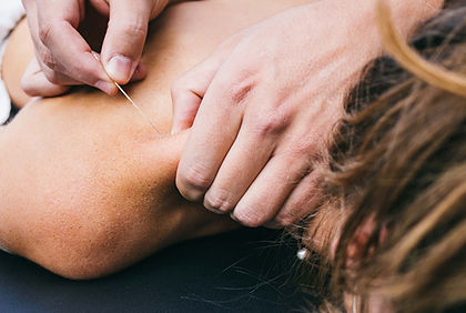 TP Acupuncture.jpeg
