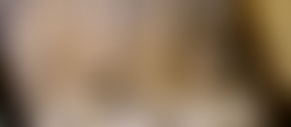 Facial Features of David (CVA)