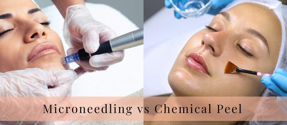 Microneedling vs. Chemical Peels: Which Advanced Facial Treatment is Right for You?
