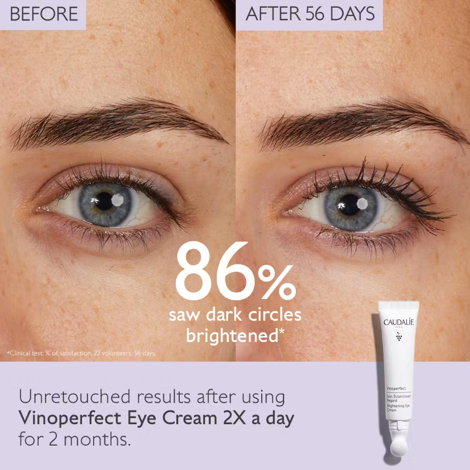 Thumbnail: Vinoperfect Dark Circle Brightening Eye Cream with Niacinamide
