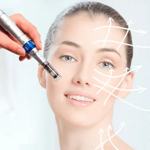 microagulhamento-dermapen-4.webp