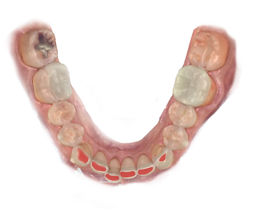 Teethwear image.png