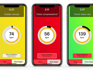 CSAR's latest publication: Evaluation of a Tap-Based Smartphone App for Heart Rate Assessment Du