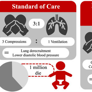 Chest Compression superimposed with Sustained Inflation – Translating preclinical findings into a neonatal clinical trial