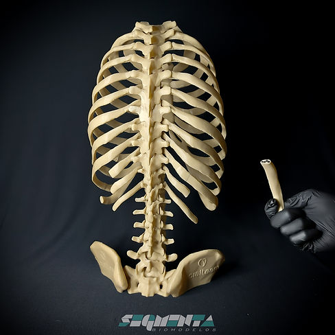 CostelasRemoviveis (12 de 18).jpg