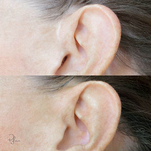 Priscila Iwama - Scars Camouflage 