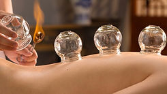 Cupping-therapy.jpg