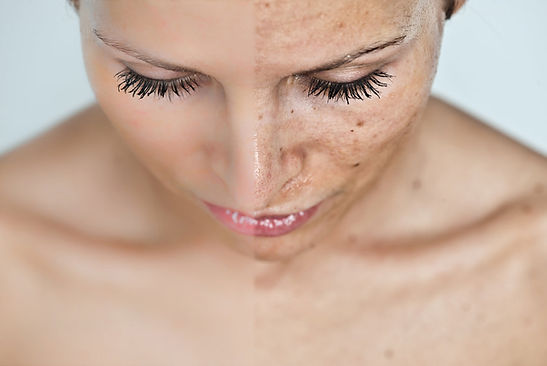 photofacialexample.jpg.95dc8497.jpg