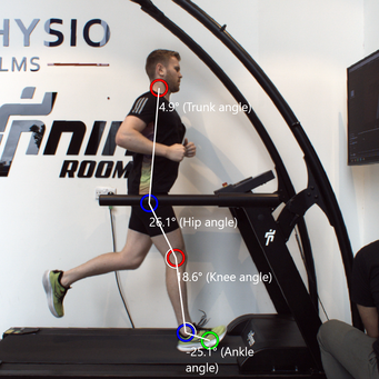 Every runner needs a physio, and not just when they’re injured.