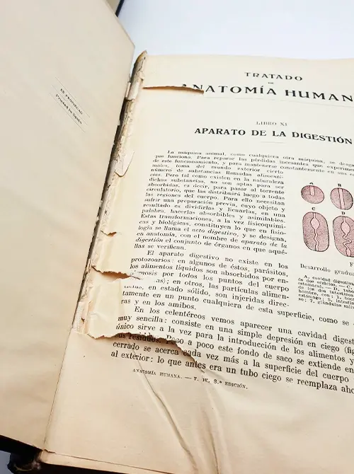 Miniatura: Tratado de Anatomía Humana Vol. II-IV